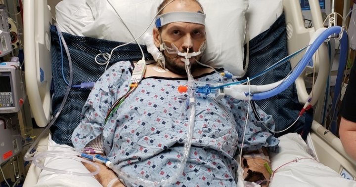 ‘It’s true what they say about dying’: Saskatoon man struggles after four flatlines