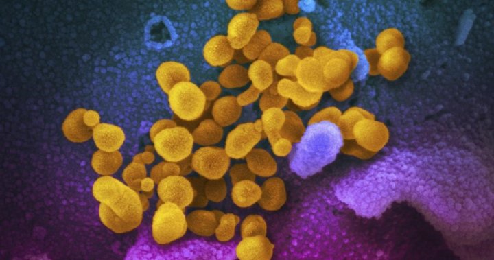 Long COVID presents ‘unfathomable’ burden as health-care system reaches ‘boiling point’ 