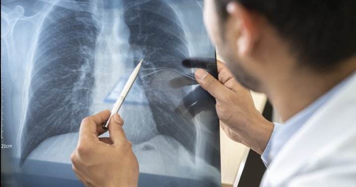 Sask. Blue Cross collaborates with Lung Saskatchewan for Long COVID project